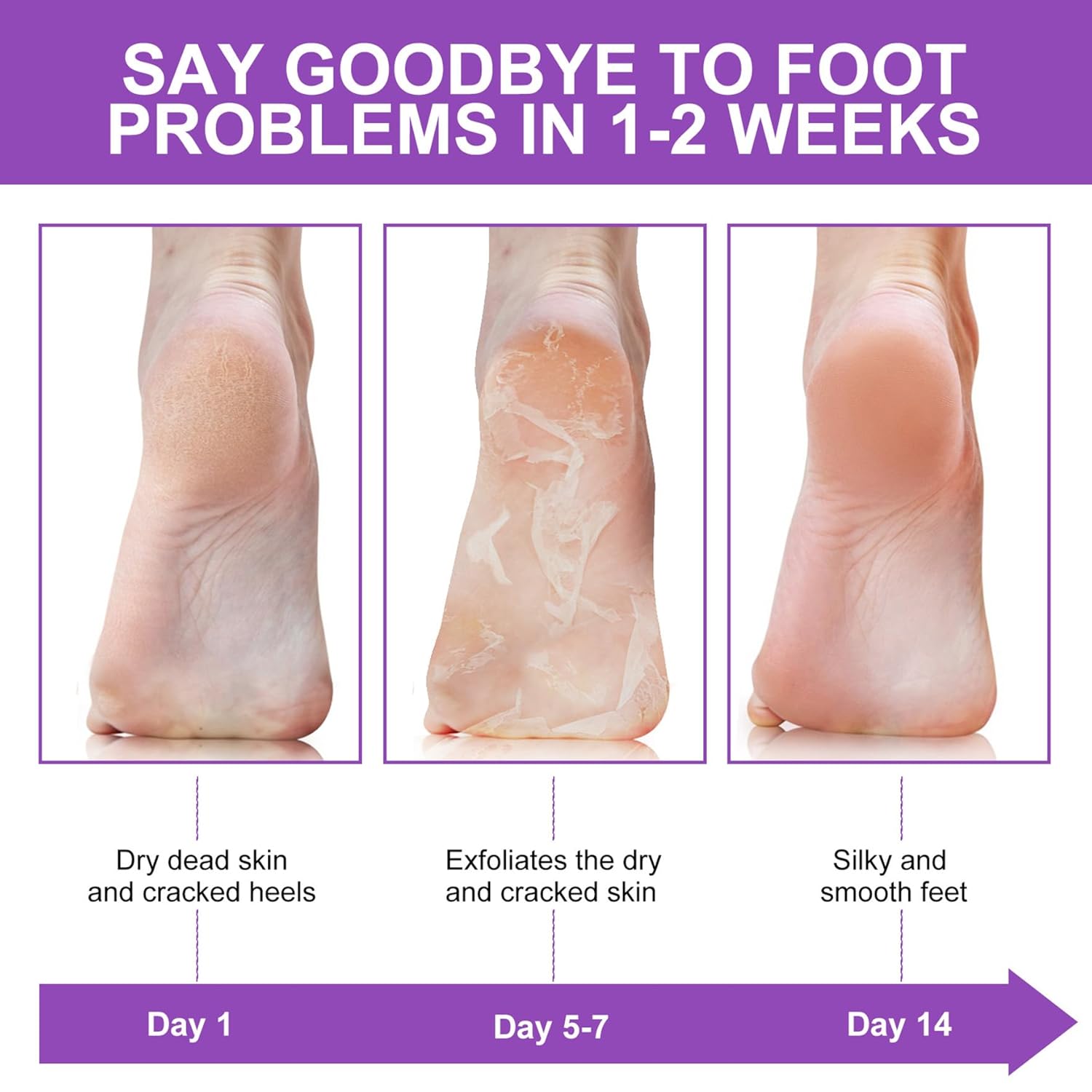 Chaussettes exfoliantes pour l - Foot Mask Peeling avis et prix